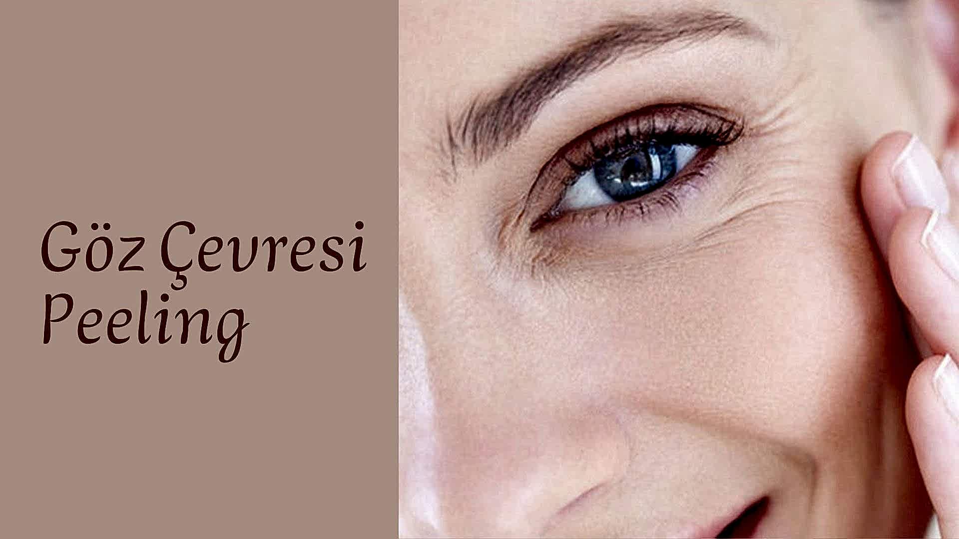 goz-cevresi-peeling