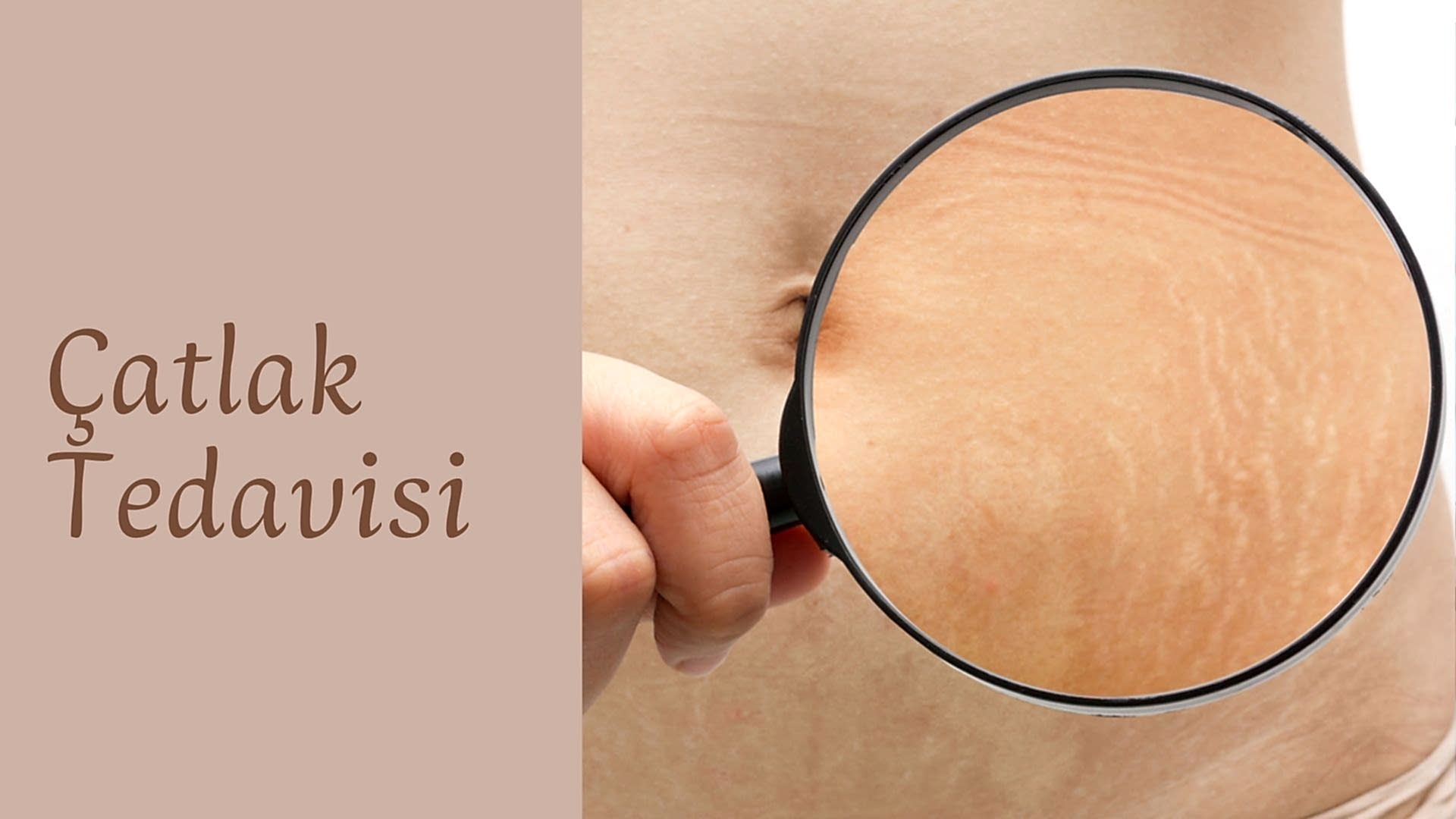 catlak-tedavisi