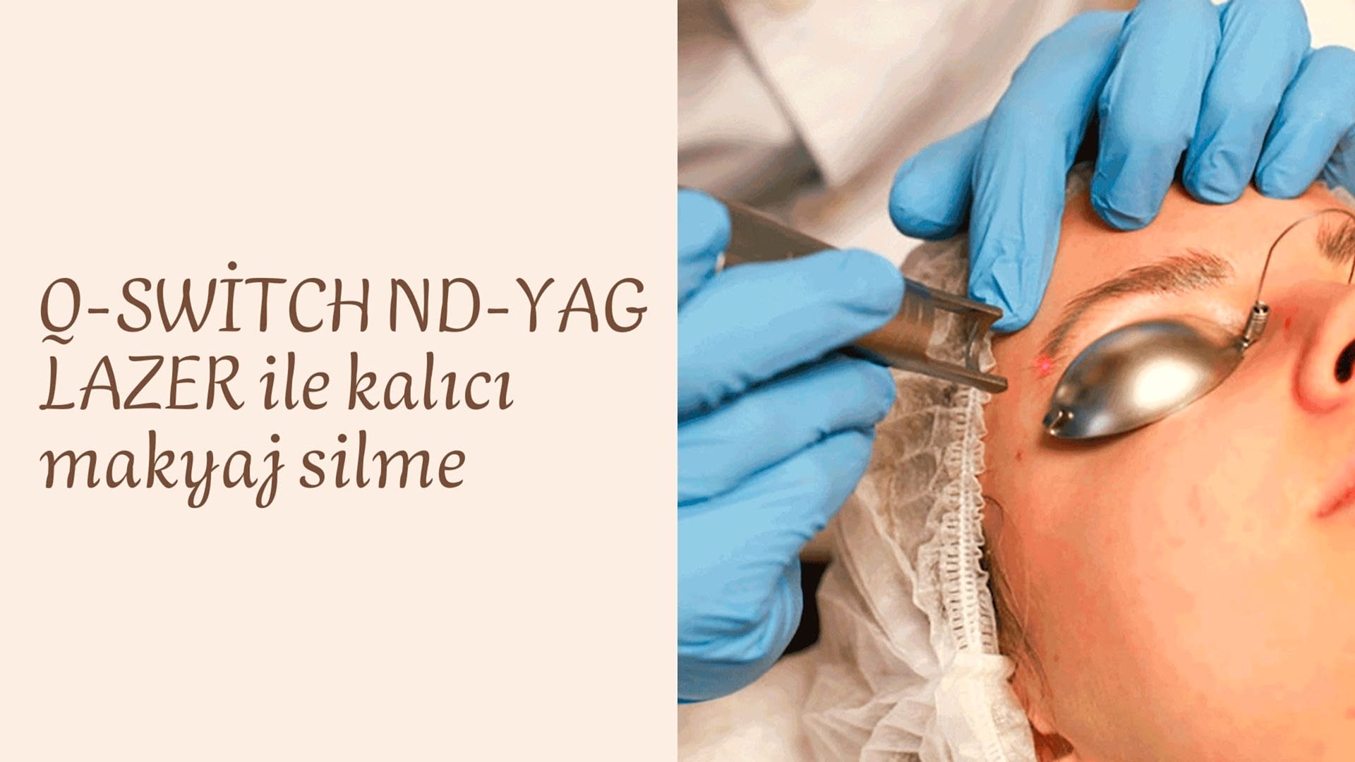 Lazerle Kaş Silme - Kalıcı Makyaj Silme