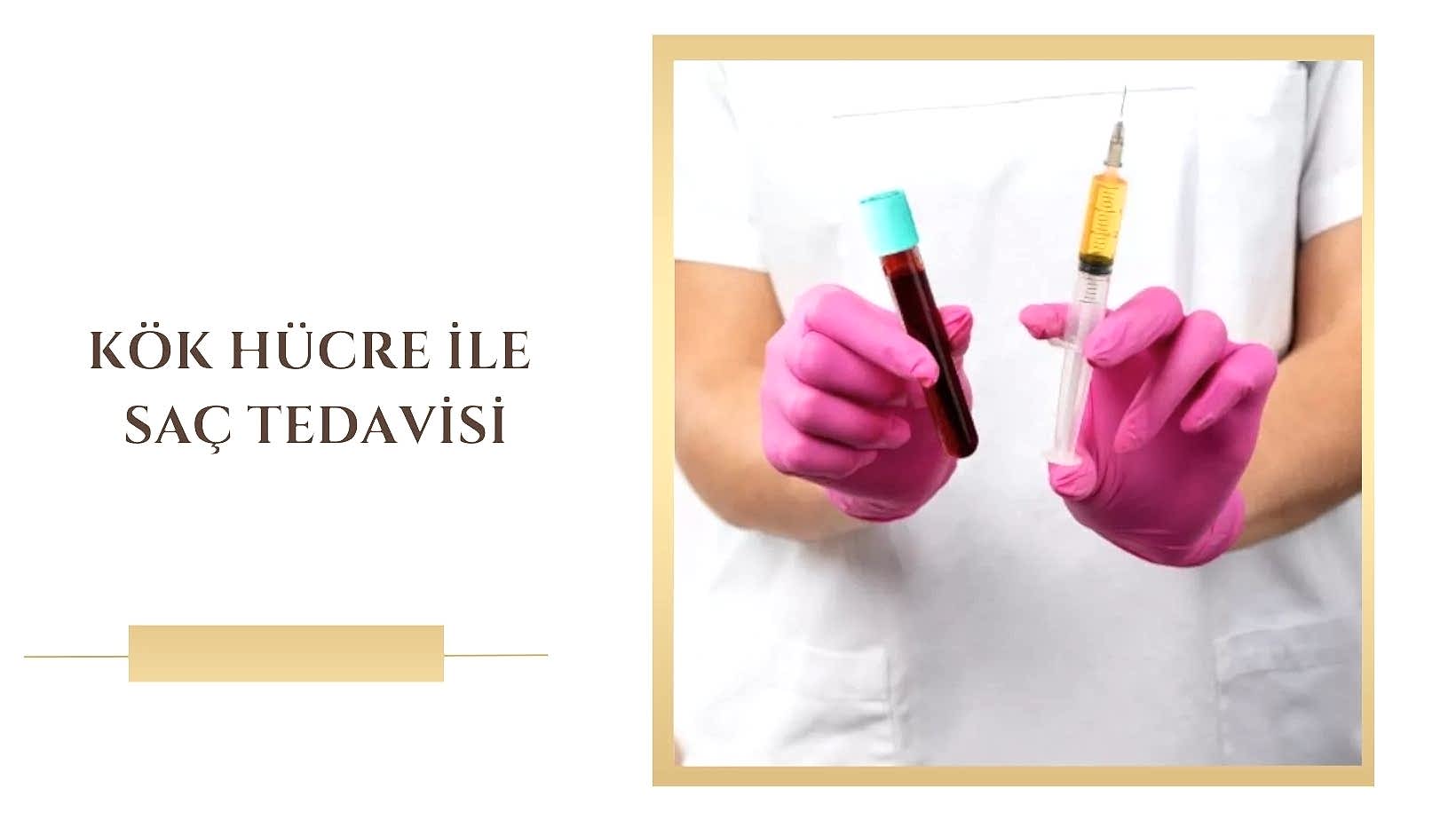 svf-ile-sac-tedavisi