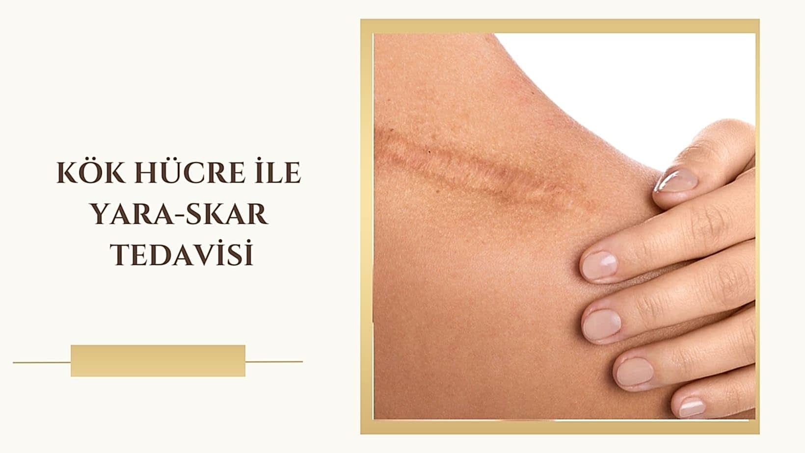svf-ile-yara-skar-izi-tedavisi
