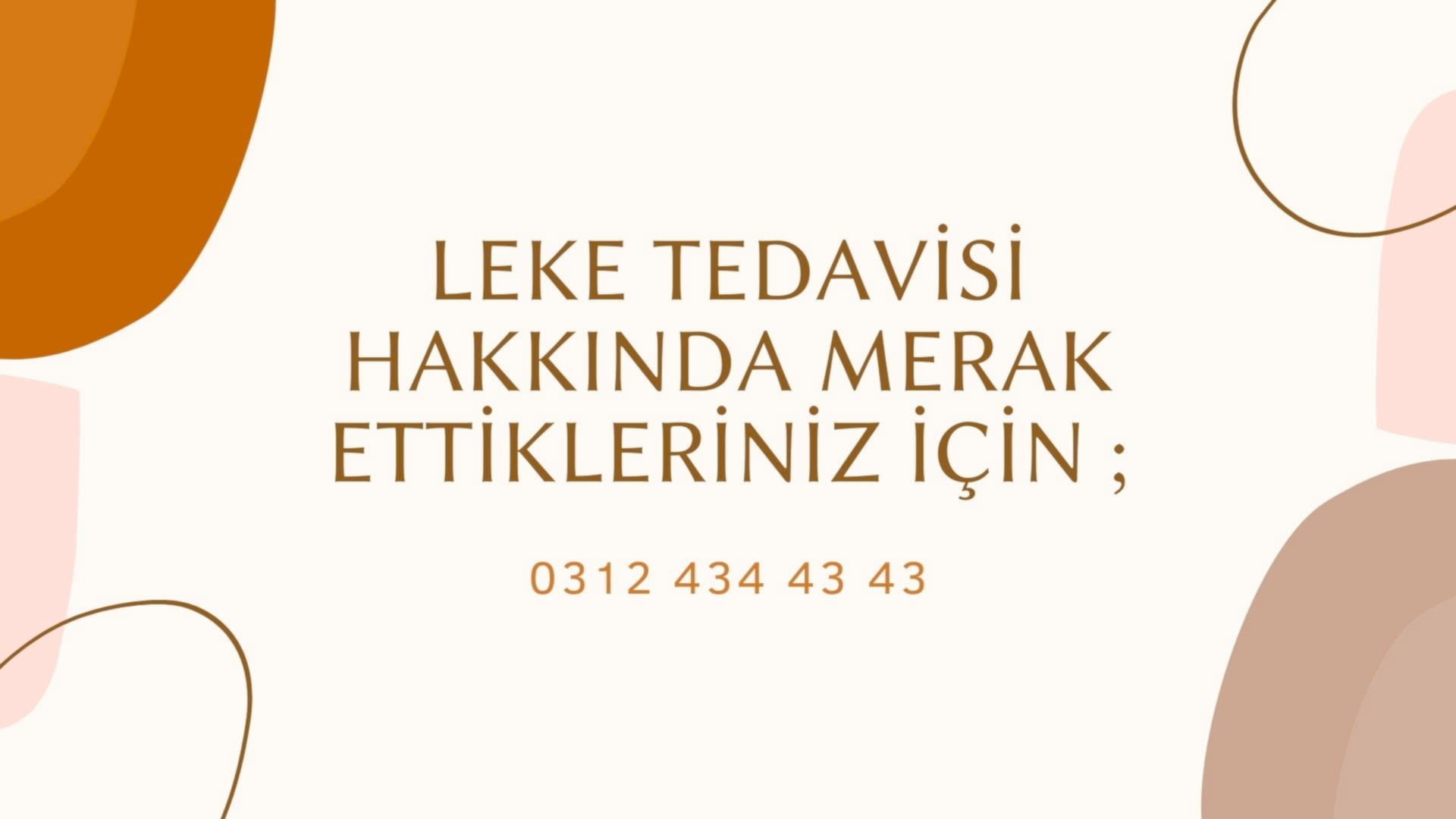 ankara-life