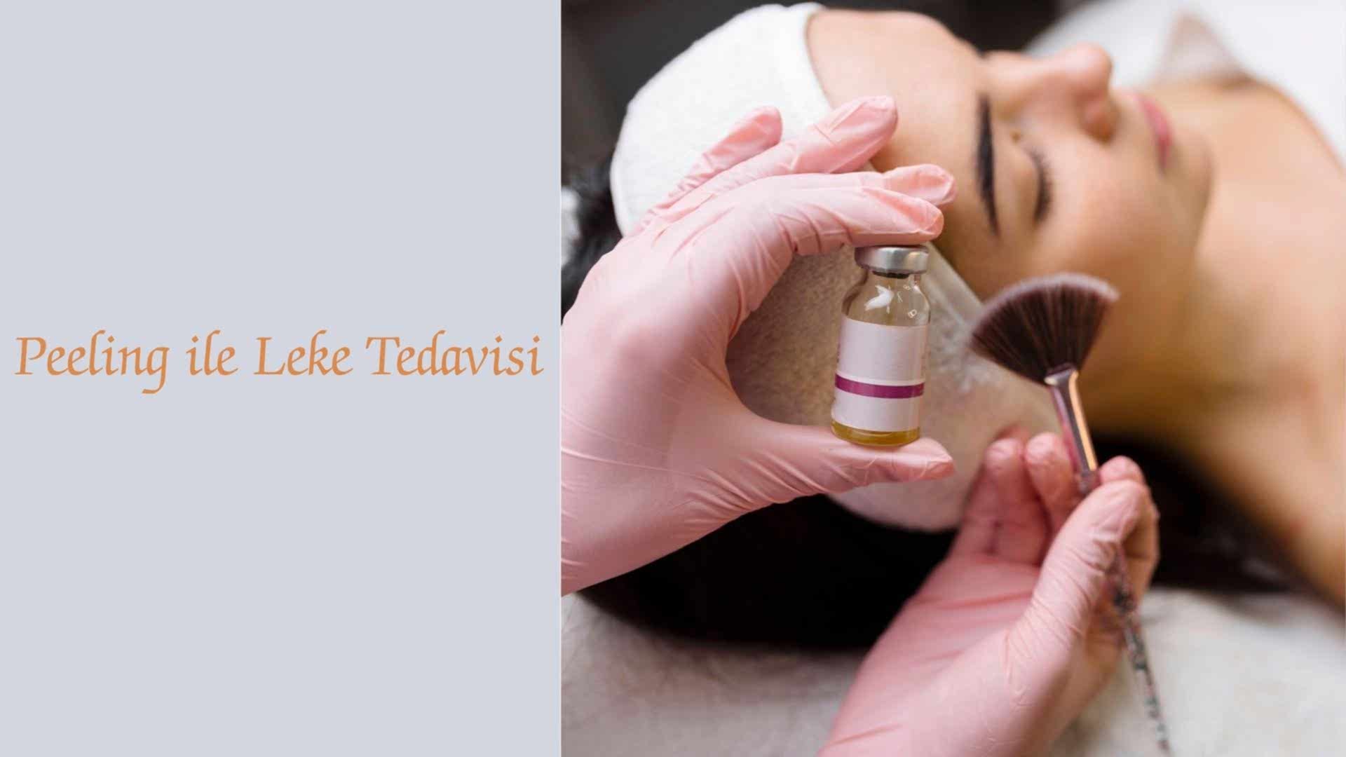 leke tedavisinde peeling
