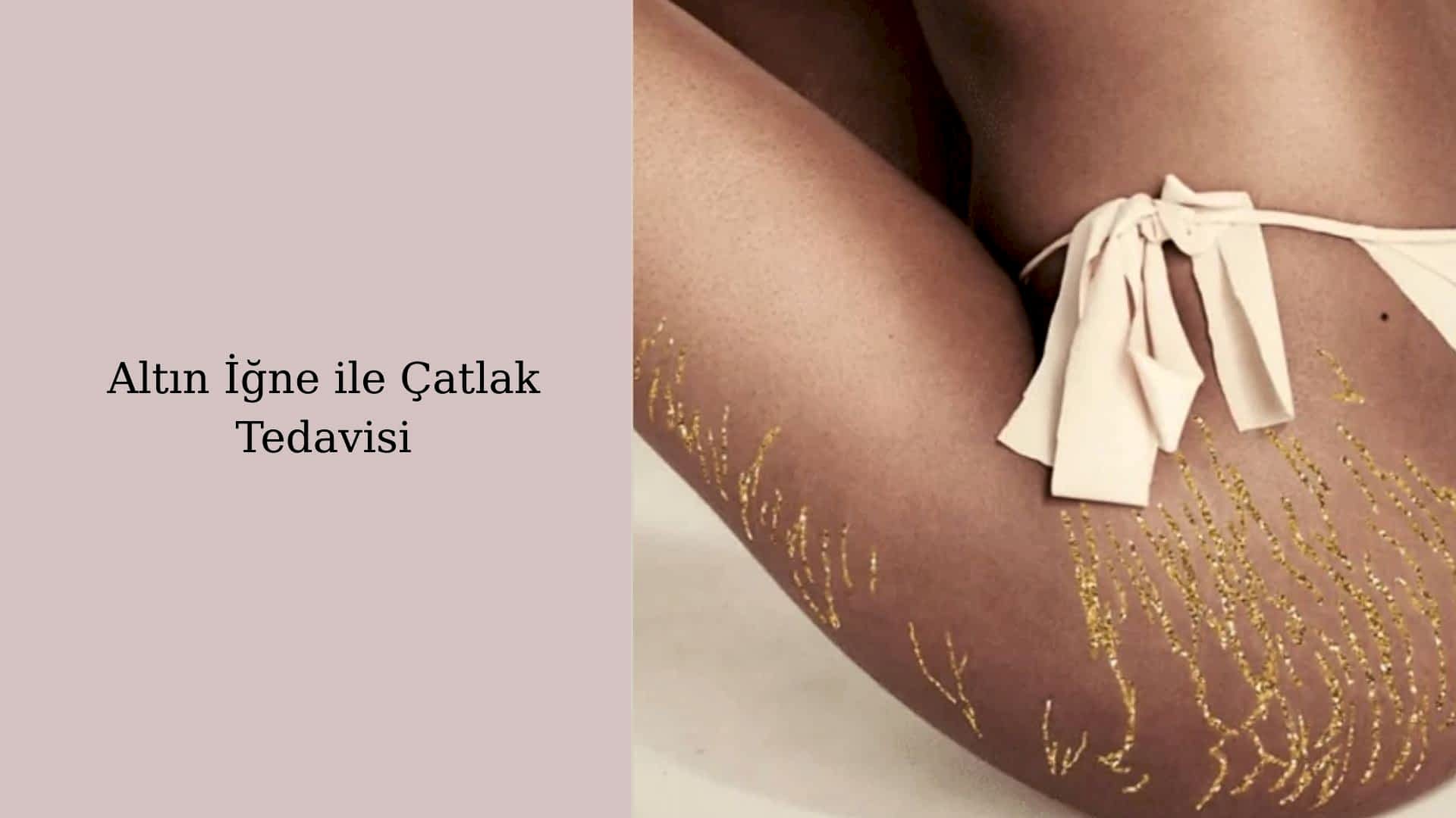 catlak-tedavisi-hizmet