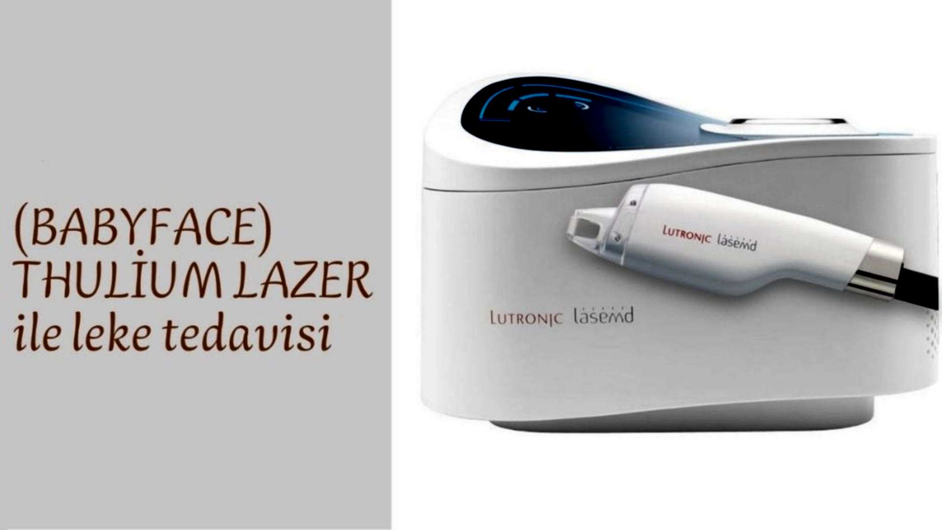 Thulium Lazer İle Leke Tedavisi