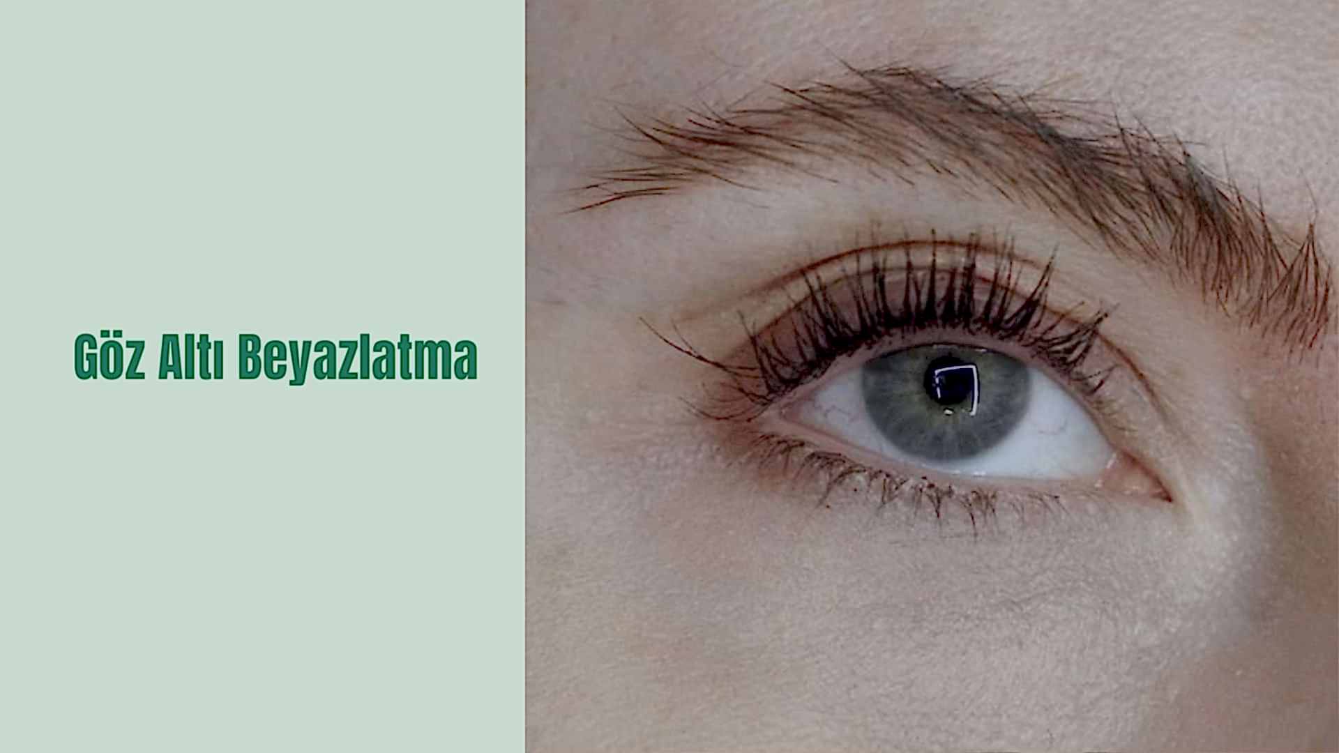 ua