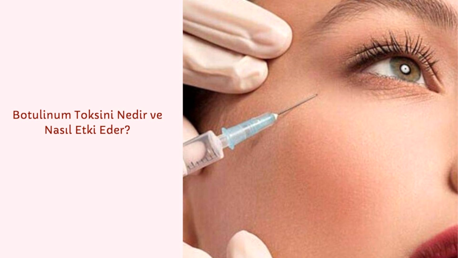 Botulinum Toksini (Botulinum toksini) Nedir ve Nasıl Etki Eder?