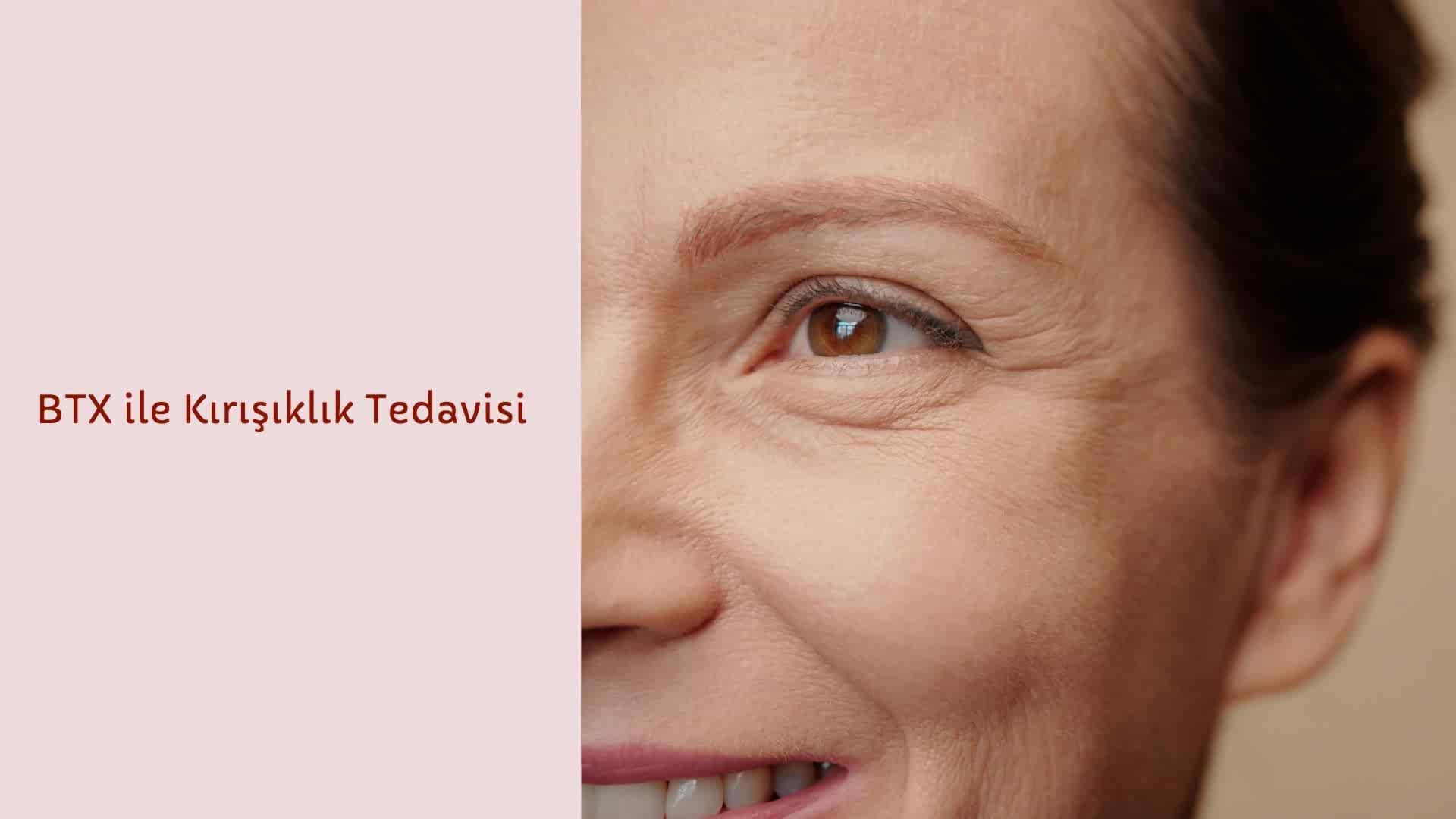 BTX ile Kırışıklık Tedavisi