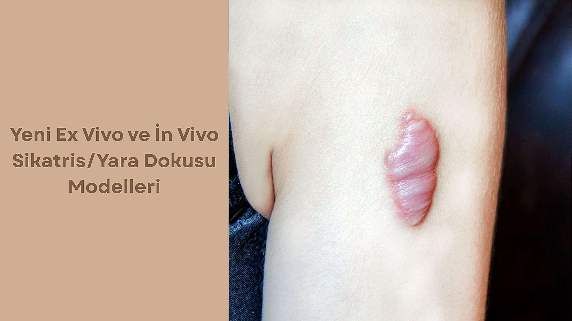 Yeni Ex Vivo ve İn Vivo Sikatris/Yara Dokusu Modelleri