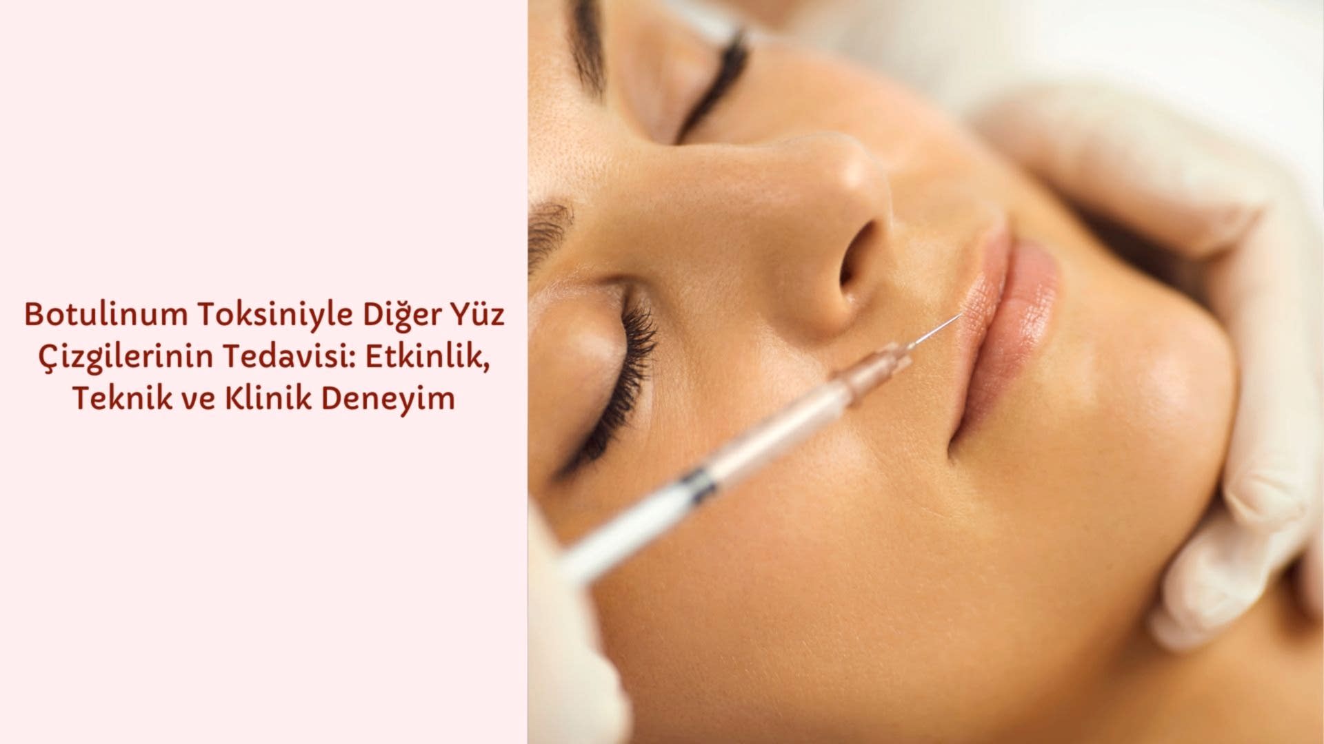 Botulinum Toksini ile Yüz Çizgilerinde Etkili ve Güvenli Uygulamalar