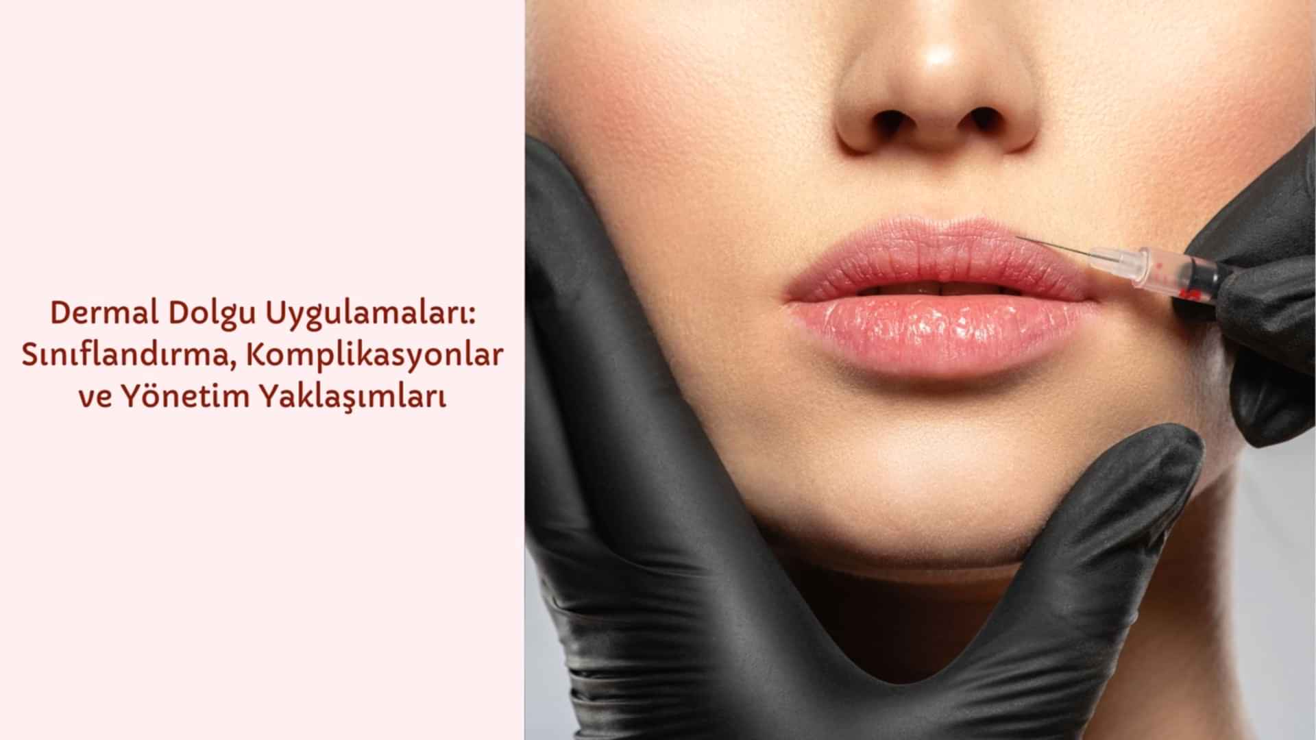 Dermal Dolgu Uygulamaları: Sınıflandırma, Komplikasyonlar ve Yönetim Yaklaşımları
