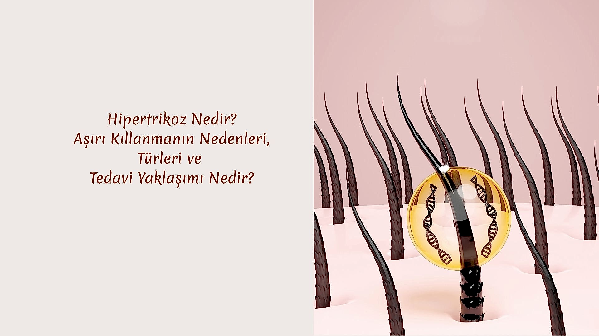 Hipertrikoz Nedir? Aşırı Kıllanmanın Nedenleri, Türleri ve Tedavi Yaklaşımı Nedir?