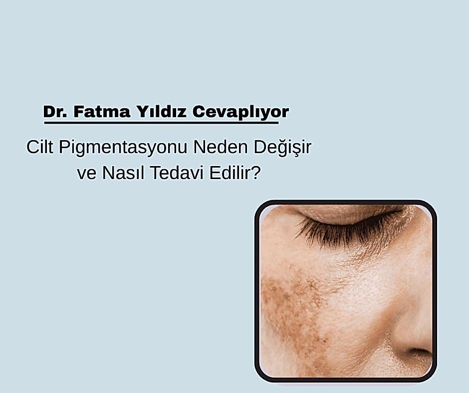 Cilt Pigmentasyonu Neden Değişir ve Nasıl Tedavi Edilir?