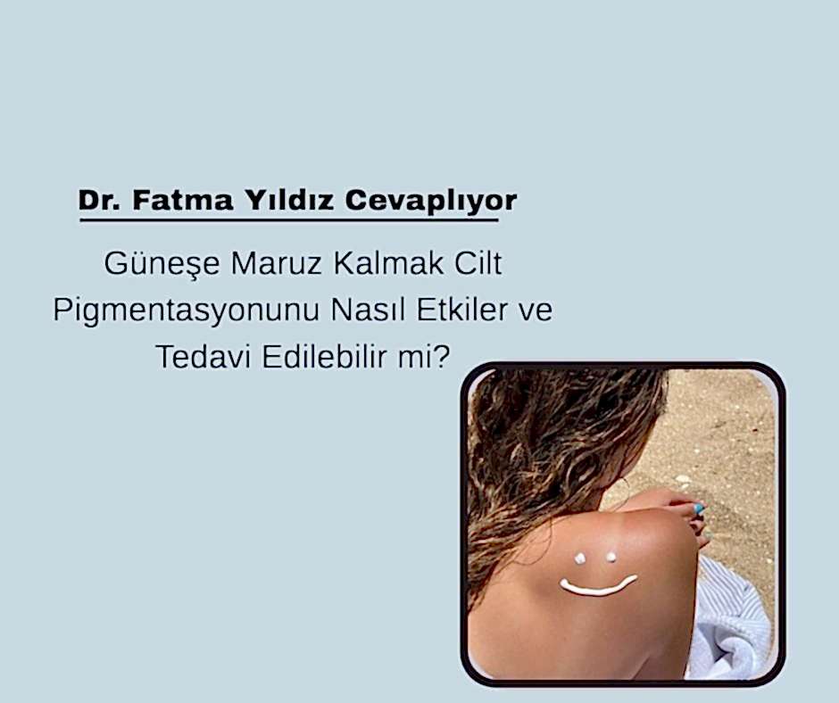 Güneşe Maruz Kalmak Cilt Pigmentasyonunu Nasıl Etkiler ve Tedavi Edilebilir mi?